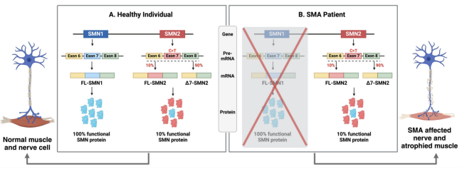 脊髓性肌萎缩症（SMA）全谱系模型：携带不同SMN2拷贝数的人源化小鼠