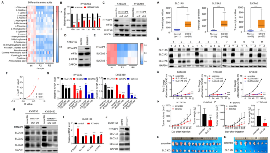 RTN4IP1通过调控氨基酸转运蛋白的表达促进ESCC发生发展