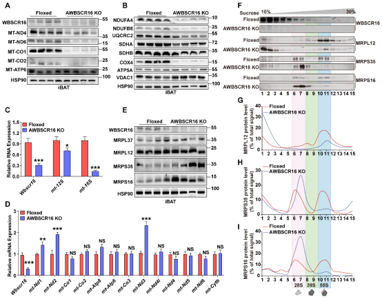 NAR|黄国瑞/宁光团队揭示WBSCR16蛋白调控线粒体核糖体16S rRNA加工并维持脂肪组织糖脂