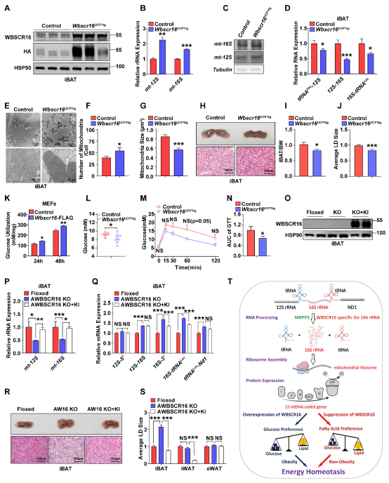 NAR|黄国瑞/宁光团队揭示WBSCR16蛋白调控线粒体核糖体16S rRNA加工并维持脂肪组织糖脂