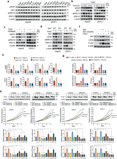 《STTT》（IF=40.8）丨肿瘤生长的“加速器”：SIX1磷酸化如何调控糖酵解和肿瘤行为