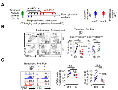 CD74high中性粒细胞激活抗肿瘤免疫并抑制非小细胞肺癌的进展