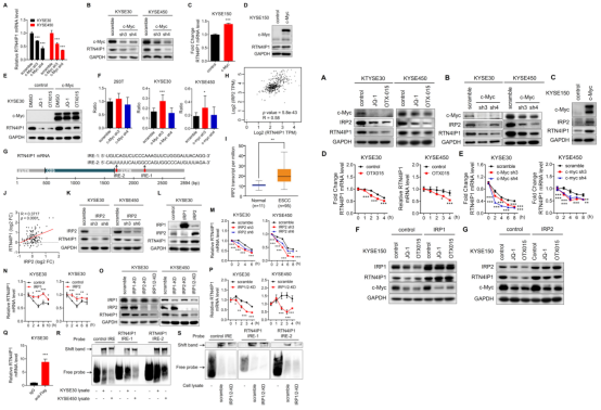 RTN4IP1通过调控氨基酸转运蛋白的表达促进ESCC发生发展