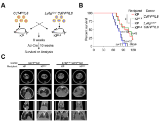 CD74high中性粒细胞激活抗肿瘤免疫并抑制非小细胞肺癌的进展
