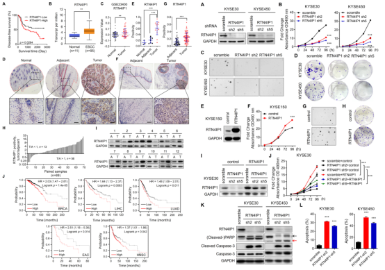 RTN4IP1通过调控氨基酸转运蛋白的表达促进ESCC发生发展