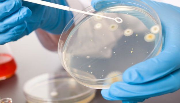 微生物操作中常见问题的讨论与分析