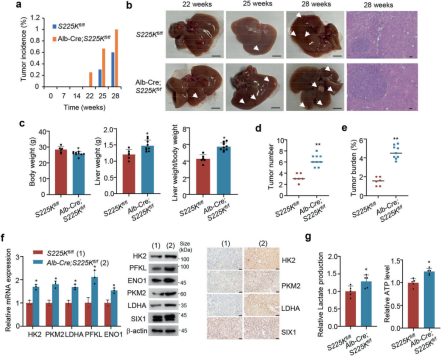 《STTT》（IF=40.8）丨肿瘤生长的“加速器”：SIX1磷酸化如何调控糖酵解和肿瘤行为