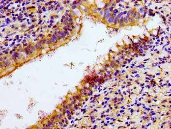 CSB-PA015551LA01HU IHC