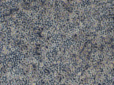 大鼠胰岛素瘤;RIN-14B