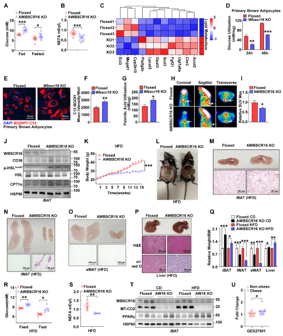 NAR|黄国瑞/宁光团队揭示WBSCR16蛋白调控线粒体核糖体16S rRNA加工并维持脂肪组织糖脂