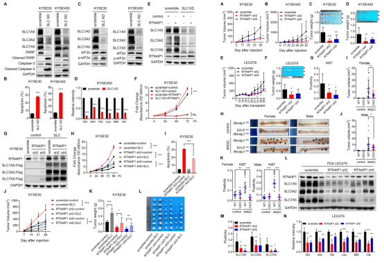 RTN4IP1通过调控氨基酸转运蛋白的表达促进ESCC发生发展