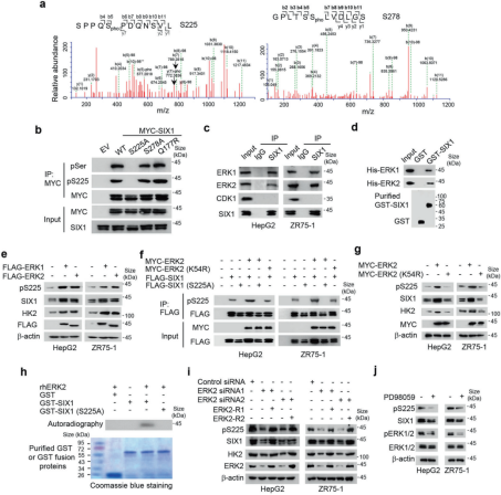 《STTT》（IF=40.8）丨肿瘤生长的“加速器”：SIX1磷酸化如何调控糖酵解和肿瘤行为