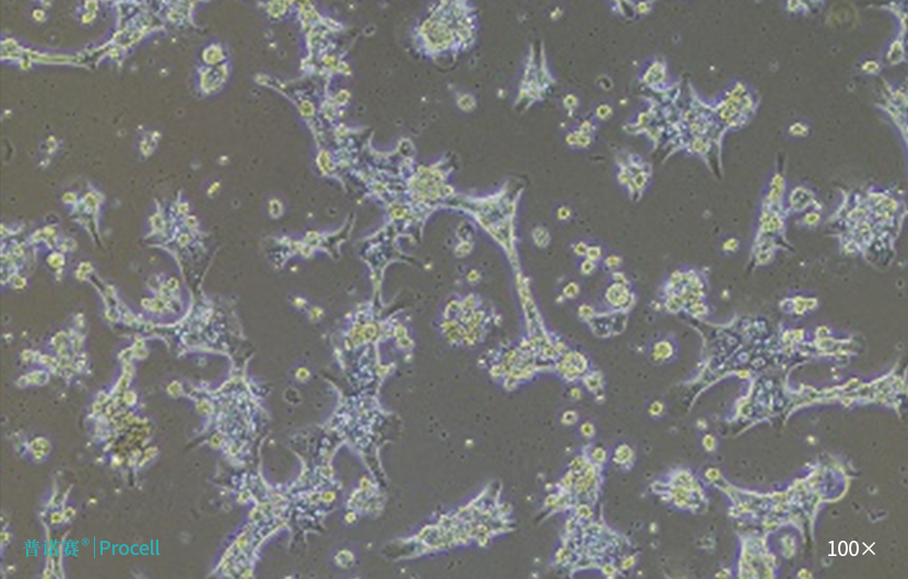 科研人必看真相|为什么原代细胞培养必须用高品质胎牛血清？