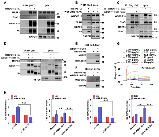 NAR|黄国瑞/宁光团队揭示WBSCR16蛋白调控线粒体核糖体16S rRNA加工并维持脂肪组织糖脂