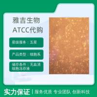 HCC1954人乳腺导管癌细胞