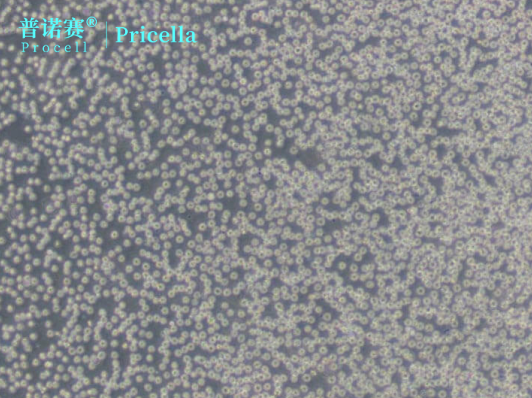 HL-60人原髓细胞白血病细胞：加速细胞毒性评估与免疫应答机制探索