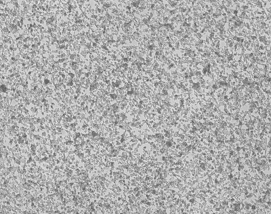 细胞攻略 | MFC(小鼠胃癌细胞)培养教程