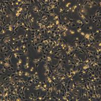 浙江(杭州)美森 人肺微血管内皮细胞HULEC-5a