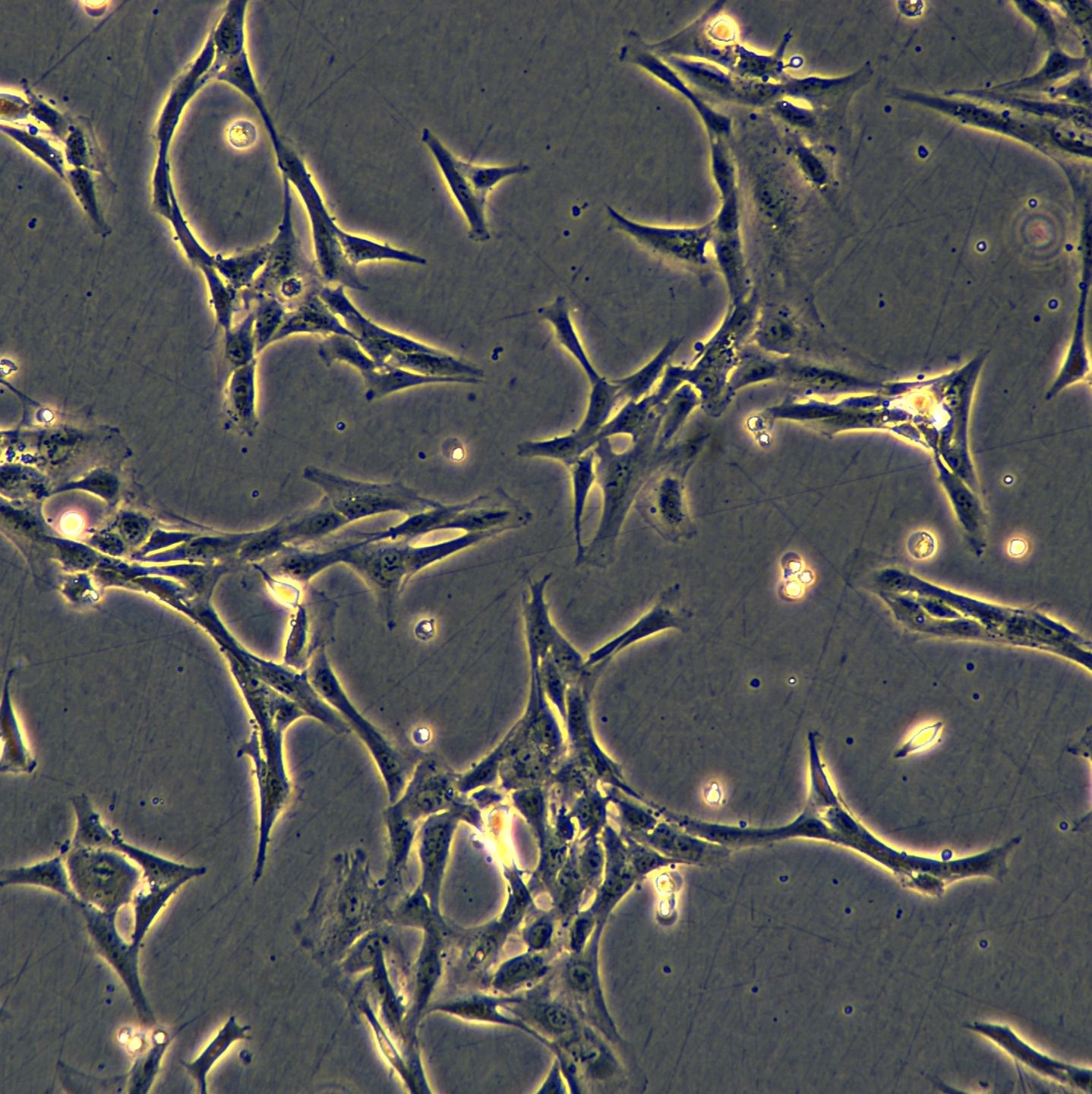 永生化人主动脉平滑肌细胞-SV40Immortalized Human Aortic Smooth Muscle Cells - SV40 (IHASMC)
