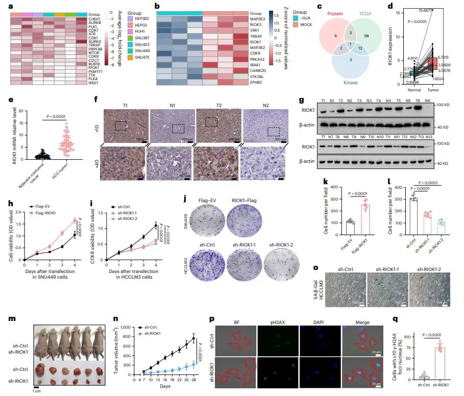 图1. 与肝细胞癌（HCC）进展相关的激酶相关基因筛选鉴定出 RIOK1。