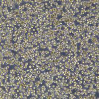 霍奇金淋巴瘤L-428