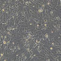 浙江美森-永生化人子宫内膜基质细胞IHESC Immortalized Human Endometrial Stromal Cells（IHESC ）