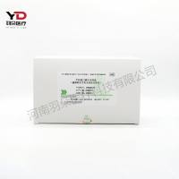 热景生物 甲胎蛋白测定试剂盒(磁微粒化学发光免疫分析法)