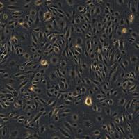 永生化人脐静脉血管内皮细胞HUVEC-SV40T