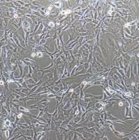 人非小细胞肺癌细胞NCI-H165