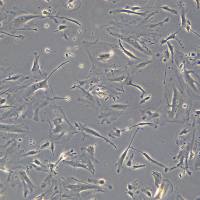 永生化肾足细胞系PODO/TERT256