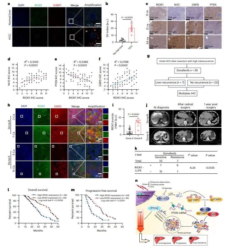 图8.RIOK1与Donafenib疗效呈负相关，并与不良预后相关。