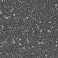 浙江(杭州)美森 小鼠主动脉血管平滑肌细胞 MOVAS