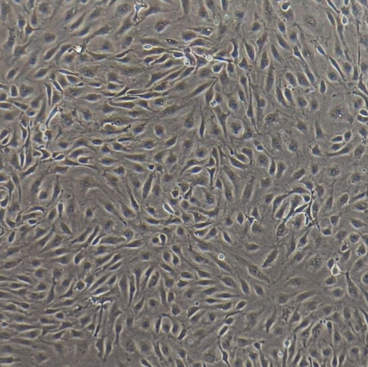  人冠状动脉内皮细胞 