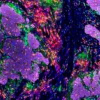 单细胞测序+多色免疫荧光mIHC