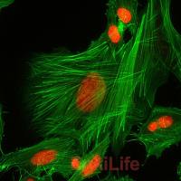 Fluorescein 488-Phalloidin（荧光素488标记鬼笔环肽）