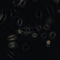 浙江美森-人肺腺鳞癌细胞HCC2279