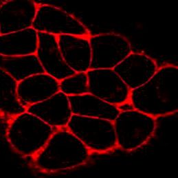 CM-DiI(细胞膜橙红色荧光探针)