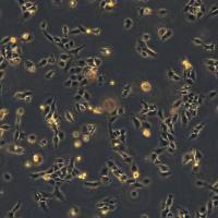 浙江美森-新型人类风湿性成纤维细胞样滑膜细胞 MH7A