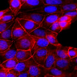 CM-DiD(细胞膜橙红色荧光探针)