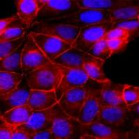 CM-DiD(细胞膜橙红色荧光探针)