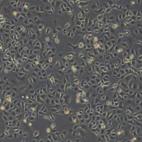 浙江（杭州）美森 人卵巢癌细胞TOV21G