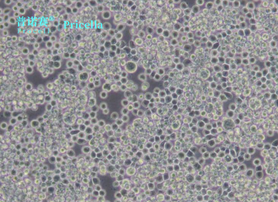 Sf9昆虫卵巢细胞常见问题：污染防控与支原体检测实用技巧