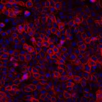 DiR(细胞膜近红外荧光探针)