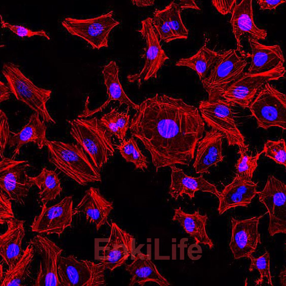Rhodamine-Phalloidin(罗丹明标记鬼笔环肽)
