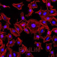 Rhodamine-Phalloidin（罗丹明标记鬼笔环肽）