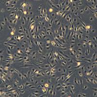 浙江美森-人主动脉内皮细胞 TeloHAEC