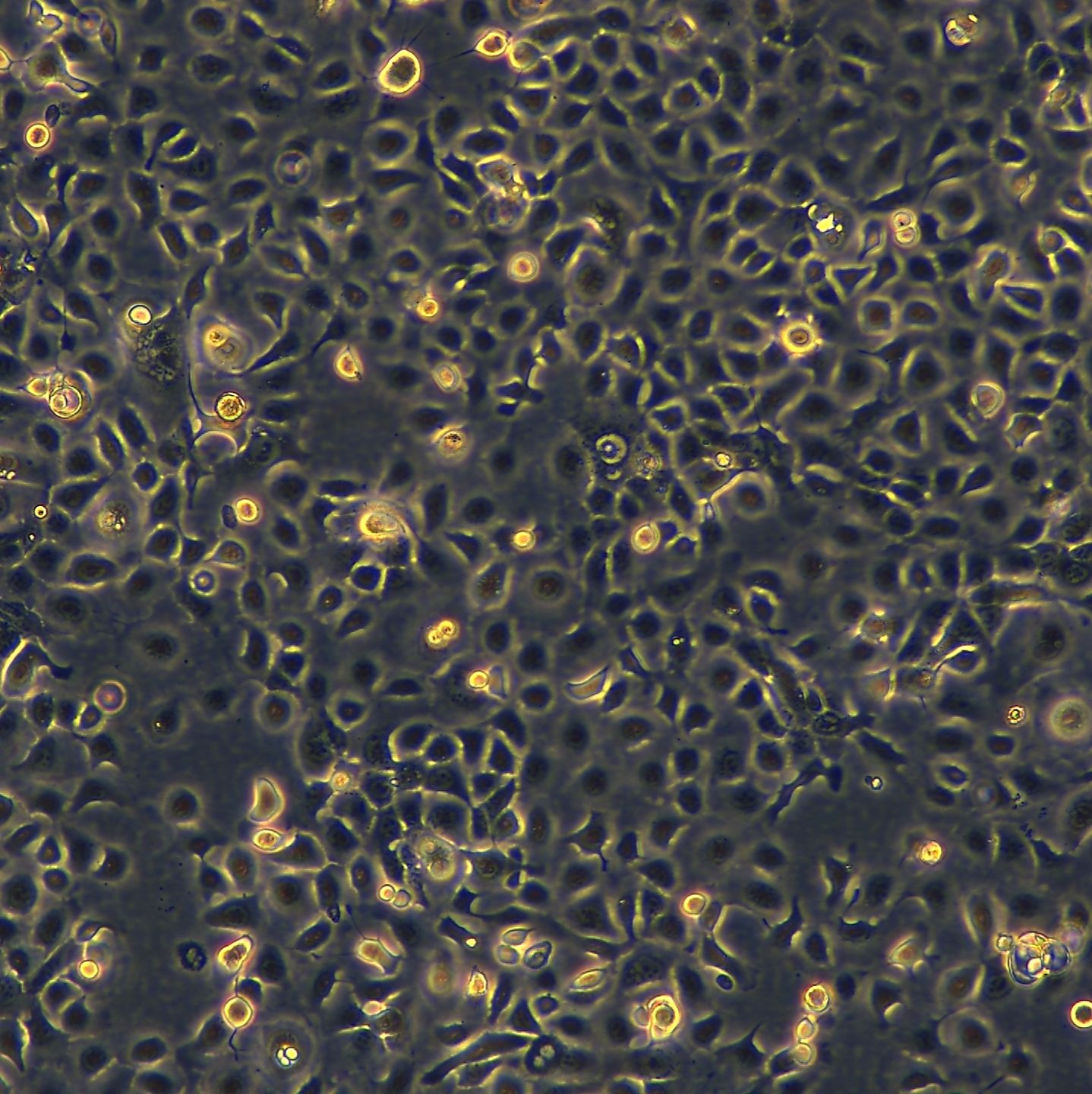 浙江（杭州）美森 小鼠口腔鳞状细胞癌细胞Mouse OSCC Cell Line (MOC1)