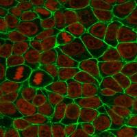 DiA(细胞膜绿色荧光探针)