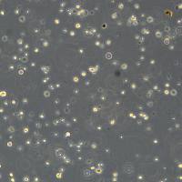 浙江美森-人肾细胞癌 CAL54