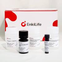 Polymer-HRP Anti-Mouse/Rabbit IHC Detection System(DAB solution)